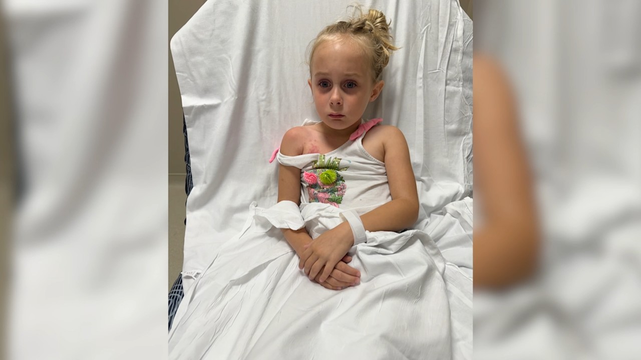 6-year-old stung by invasive clinging jellyfish in New Jersey's Metedeconk River